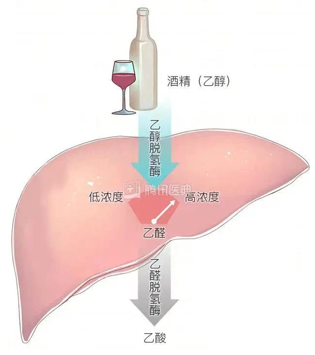 艾诗特3499拉斯维加斯